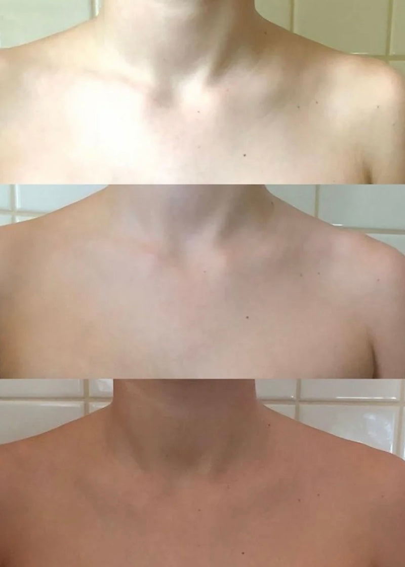 Winter Skin